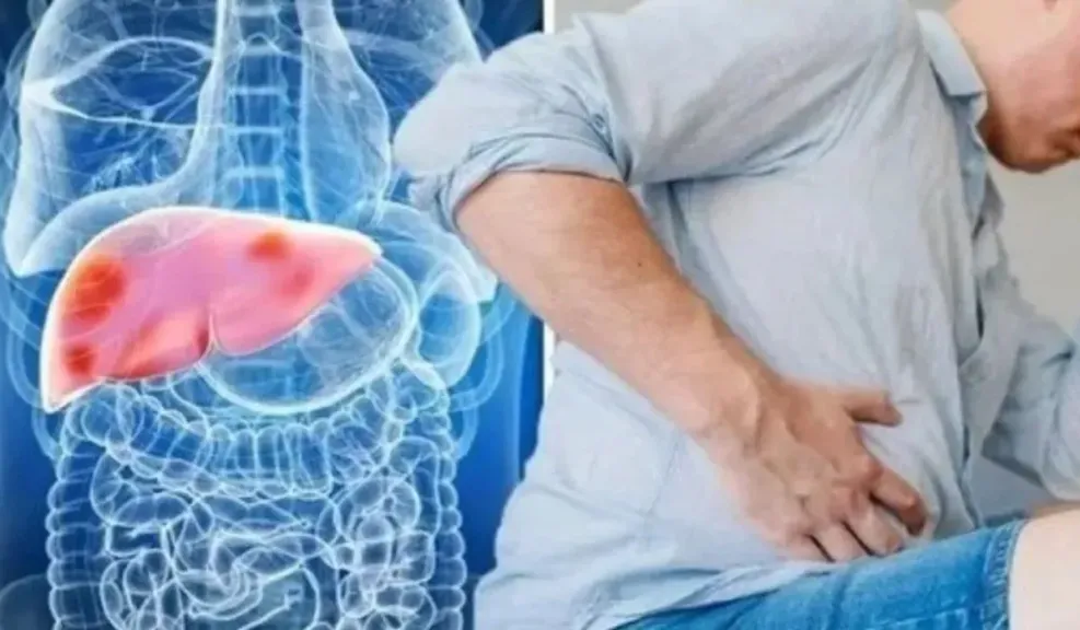 اعراض الكبد الدهني