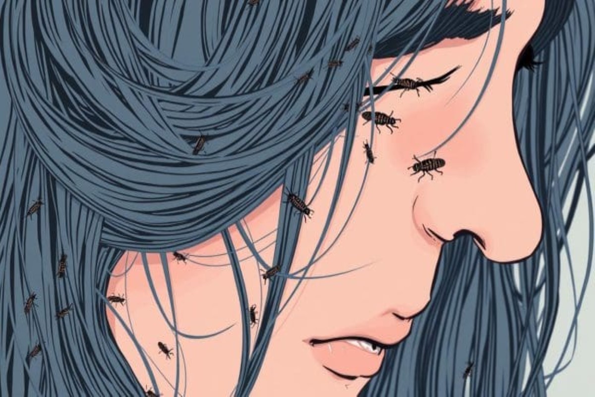 تفسير حلم القمل في الشعر وقتله